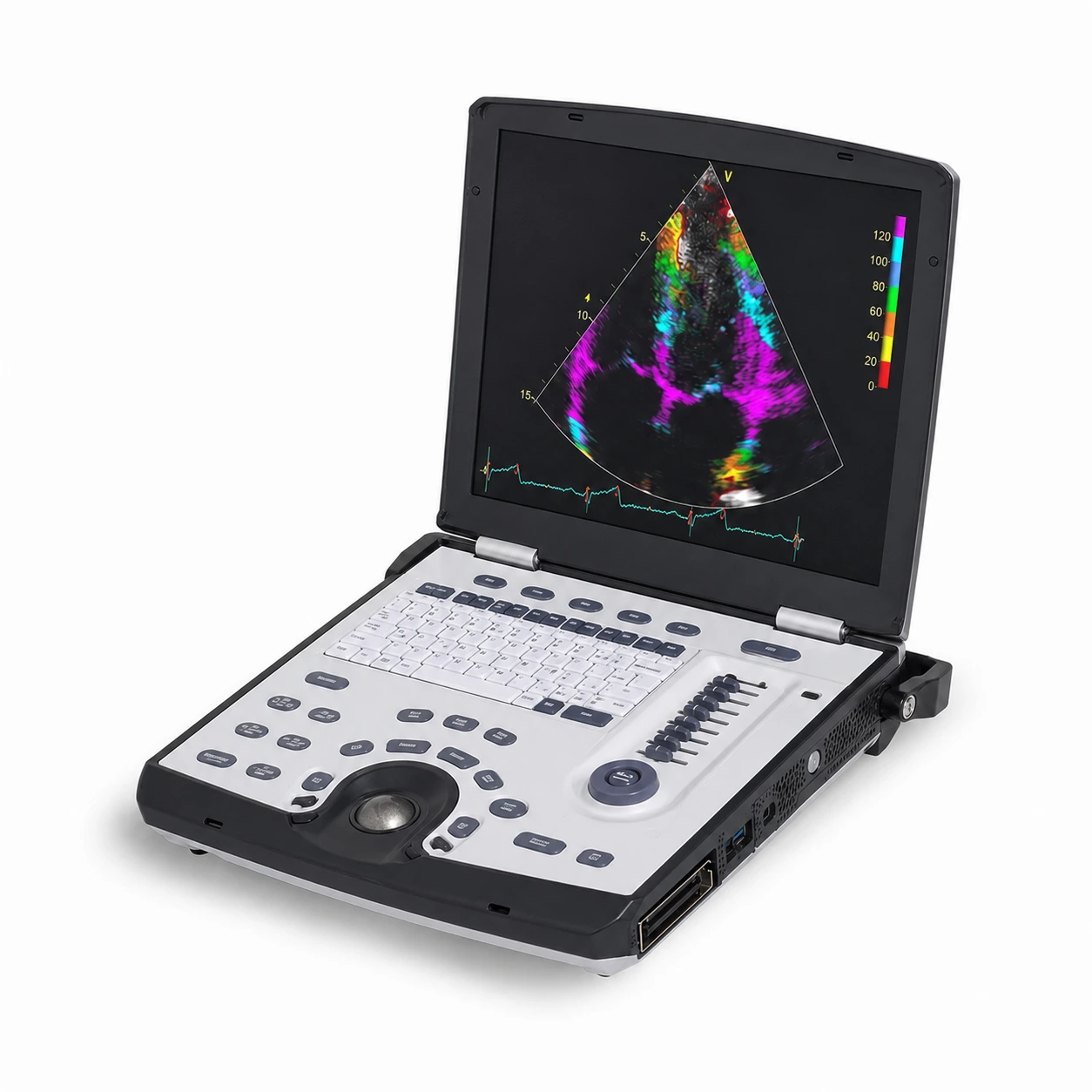 A 2D echocardiogram showing a four-chamber view of the heart on the ultrasound machine, with an ECG trace below the image